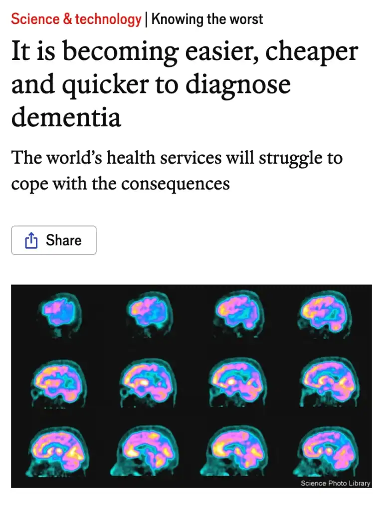 When it matters - the-economist-it-is-becoming-easier-cheaper-and-quicker-to-diagnose-dementia